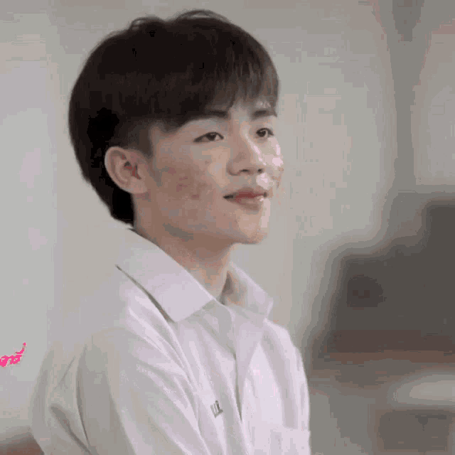 a young man with acne on his face is wearing a white shirt and looking at the camera .
