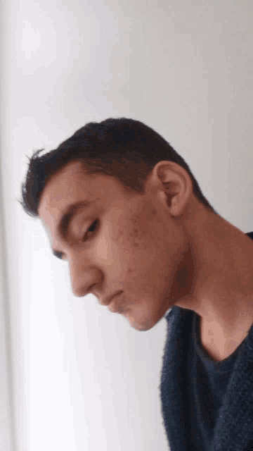 a man with acne on his face looks down
