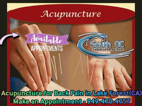 Acupuncture In Orange County Orange County Acupuncture GIF - Acupuncture In Orange County Orange County Acupuncture Lake Forest Acupuncture GIFs