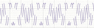 a graph showing the letters n and w on a grid paper