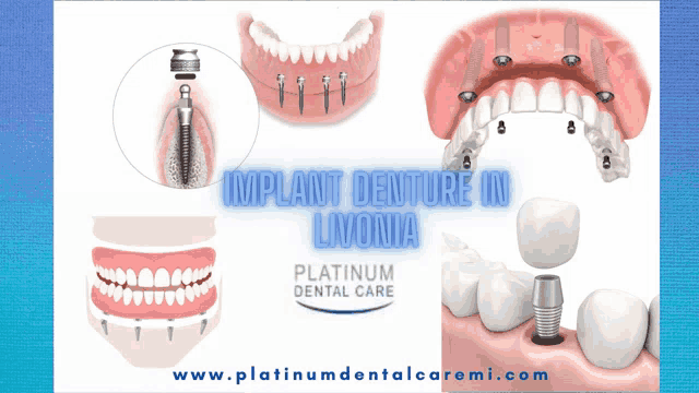 an advertisement for platinum dental care shows a picture of a denture