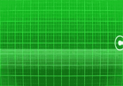 a green screen with a heartbeat monitor showing a heartbeat .