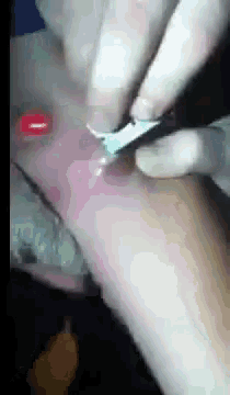a close up of a person getting a tattoo on their leg