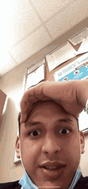 a man wearing a mask is making a funny face while holding his hand to his forehead .