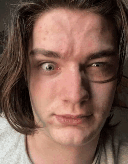 a young man with long hair is making a funny face while wearing glasses .
