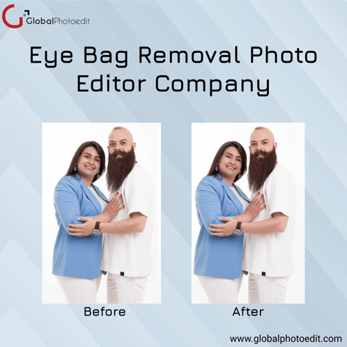 Eye Bag Removal Photo Editor Company GIF - Eye Bag Removal Photo Editor Company GIFs
