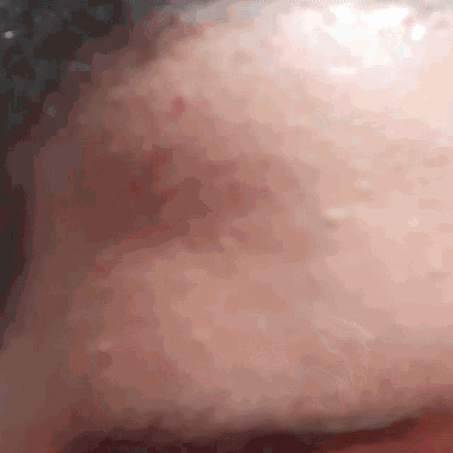 a close up of a person 's face with a few white spots