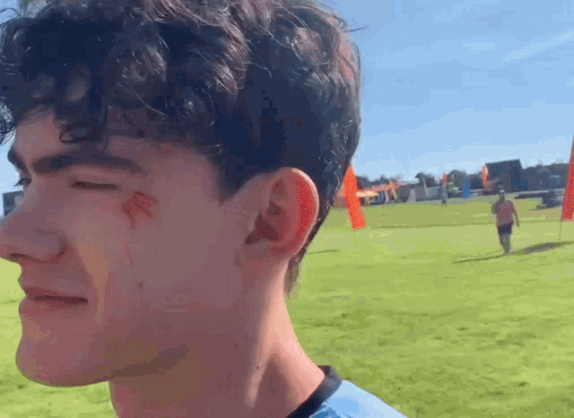 a young man with a scar on his face that says ae