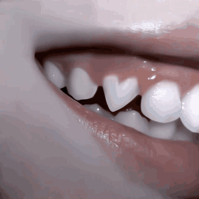 a closeup of a person 's teeth with a heart shaped tooth
