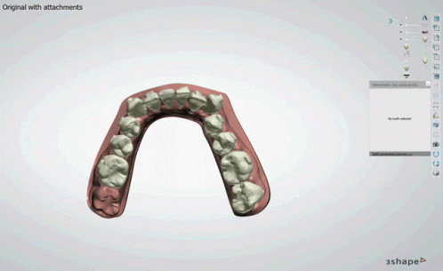 Verdun Teeth GIF - Verdun Teeth Dentures GIFs