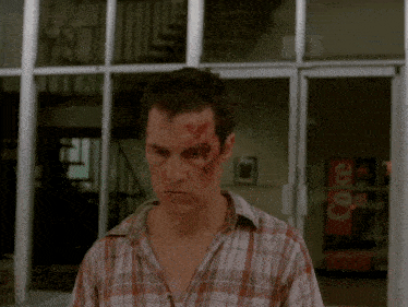 a man in a plaid shirt has a scratch on his forehead in front of a coke machine