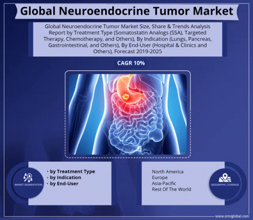 Global Neuroendocrine Tumor Market GIF - Global Neuroendocrine Tumor Market GIFs