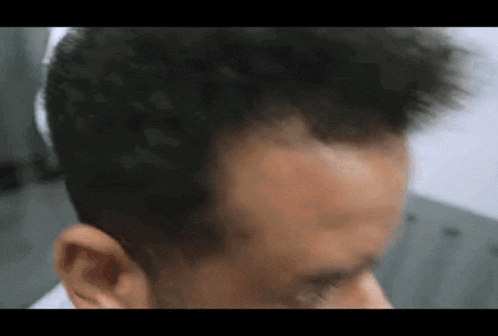 a close up of a man 's forehead with a white shirt on