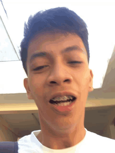 a young man with braces on his teeth makes a face