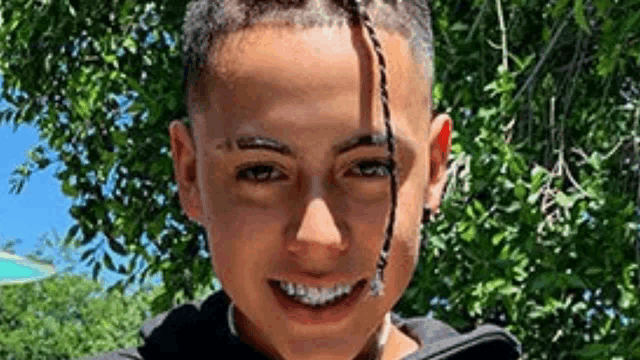 a young boy with braces on his teeth is smiling for the camera while standing in front of a tree .