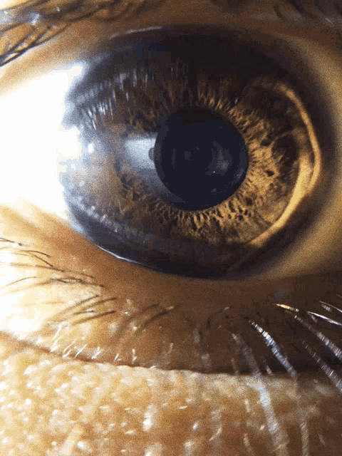 a close up of a person 's eye showing the pupil
