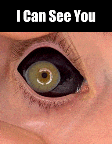 I Can See You Black Eye GIF - I Can See You See See You GIFs