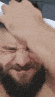 a man with a beard and a hand on his head