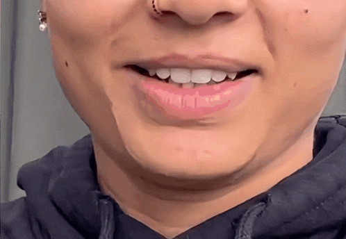 a close up of a woman 's mouth with her teeth showing