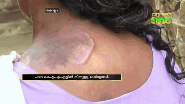 a woman 's neck is shown on a television screen with the letters media on it