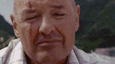 a close up of a man 's face with a stitch on his forehead .