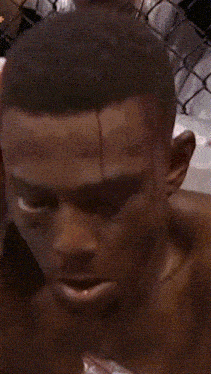 a close up of a man 's face with blood on his forehead and mouth open