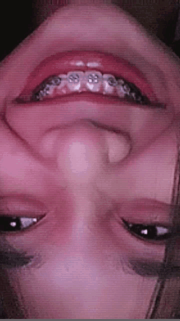 a close up of a woman 's face with braces on it .