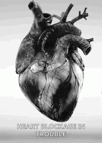 Heart Blockage In Trouble Black Heart GIF