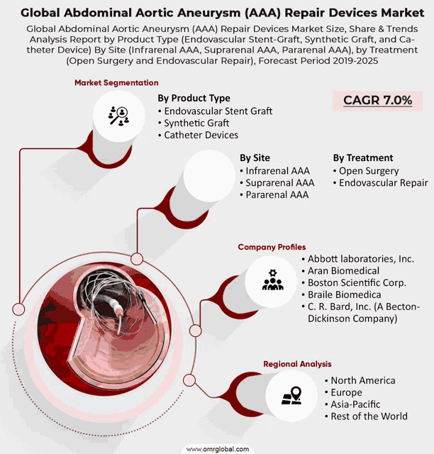 an advertisement for global abdominal aortic aneurysm repair devices