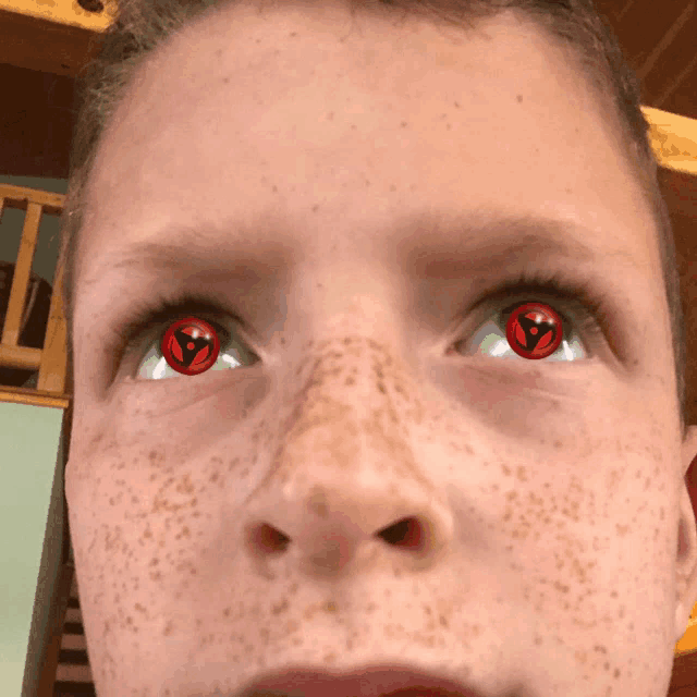 a close up of a boy 's face with red eyes and freckles
