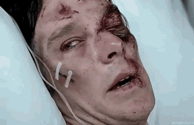 Injured Benedict Cumberbatch GIF - Injured Benedict Cumberbatch Drstrange GIFs