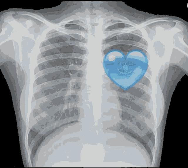 Radiologia Heart GIF - Radiologia Heart Love GIFs