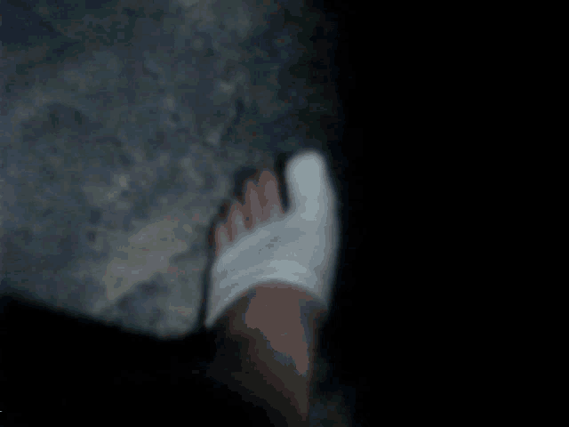 a person 's foot with a white bandage on their toe