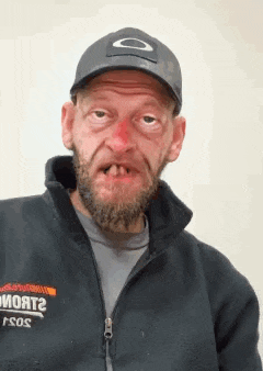 a man with a beard and missing teeth is wearing a hat and jacket .