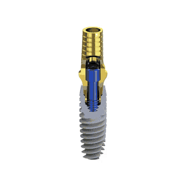 an illustration of a dental implant showing the inside of the screw