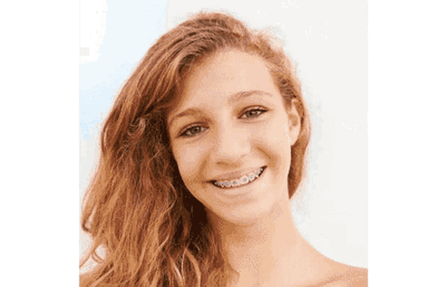 a young woman with braces on her teeth is smiling