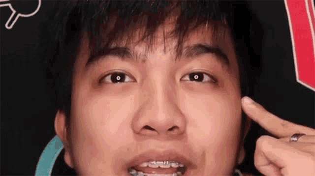 a close up of a man with braces on his teeth pointing at his face .