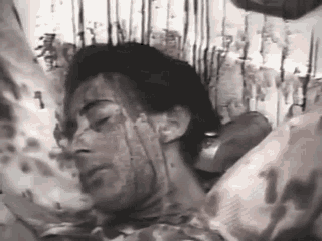 a man with blood on his face is laying on a bed