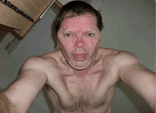 a man without a shirt has a red face