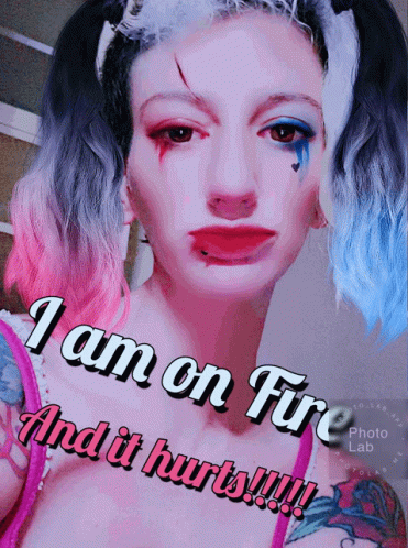 Burn I Am On Fire GIF - Burn I Am On Fire It Hurts GIFs