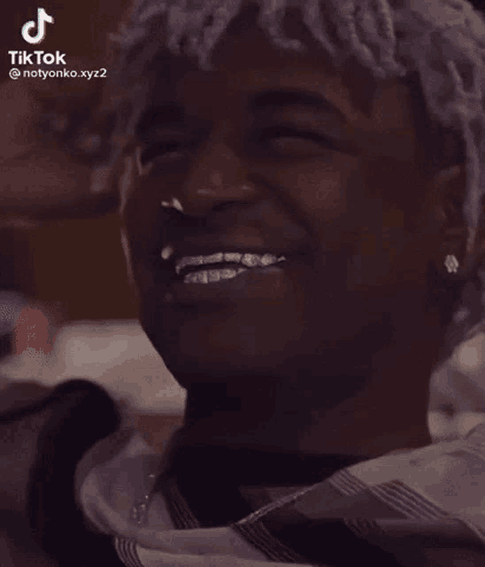 a young man with braces on his teeth is smiling .