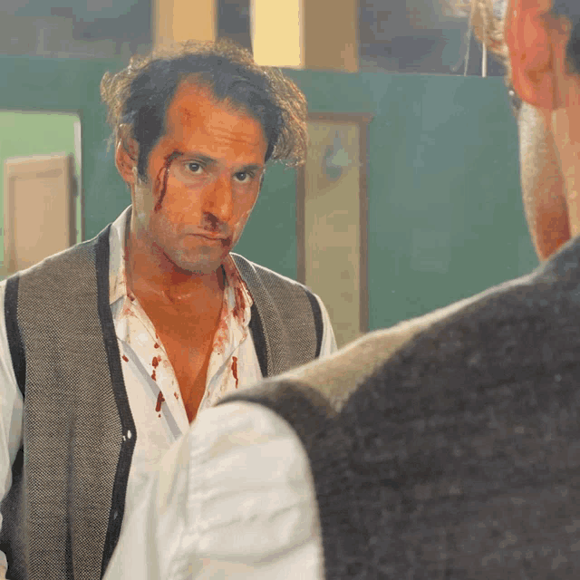 a man with blood on his shirt looks at another man