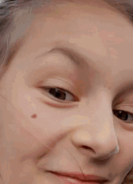 a close up of a girl 's face with a spot on her cheek .