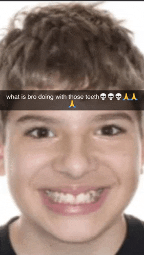 a picture of a young boy with a caption that says " what is bro doing with those teeth "