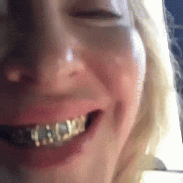 a close up of a woman 's face with braces on her teeth smiling .