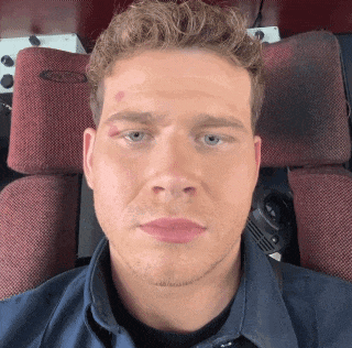 a man with a red spot on his forehead is sitting in a chair