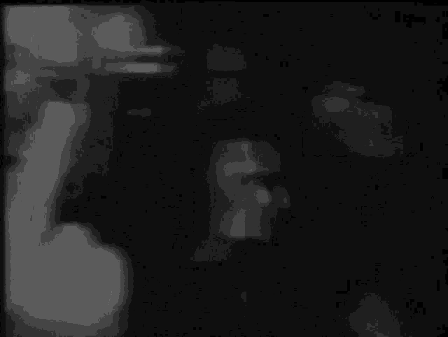 it is a black and white photo of a man holding his head .