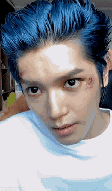 a young man with blue hair has a bruise on his face