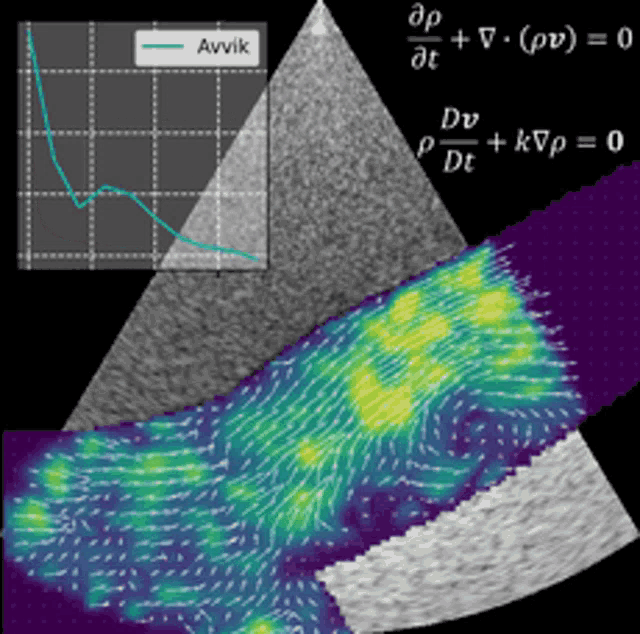 Ultrasound Aorta GIF - Ultrasound Aorta Graph GIFs