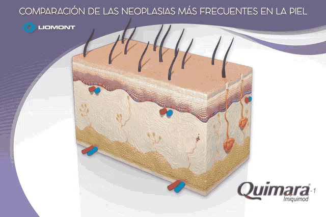 an advertisement for quimara shows the layers of the skin and hair